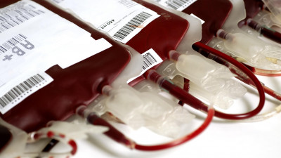 Cara Aman Donor Darah Ditengah Pandemik Corona